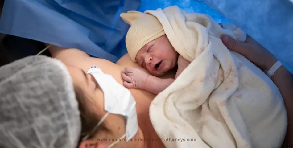 C-Section Lawsuits